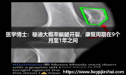 医学博士：穆迪大概率髌腱开裂，康复周期在9个月至1年之间